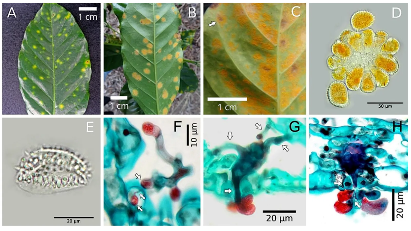 Planche de huit vignettes : face supérieure d'une feuille tachée de jaune, face inférieure couverte de pustules orangées, gros plan sur les pustules, puis en microscopie un sore, une urédiniospore épineuse et des haustoria colorés en rouge dans le tissu foliaire.