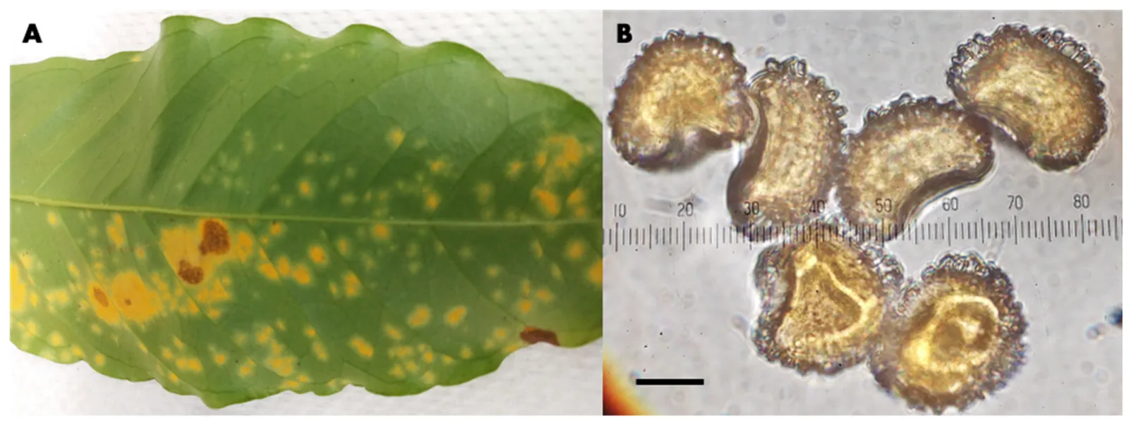 À gauche une feuille verte constellée de petites taches jaunes et de deux plages orangées ; à droite six urédiniospores vues au microscope optique, en forme de rein et hérissées d'épines, devant une graduation micrométrique.