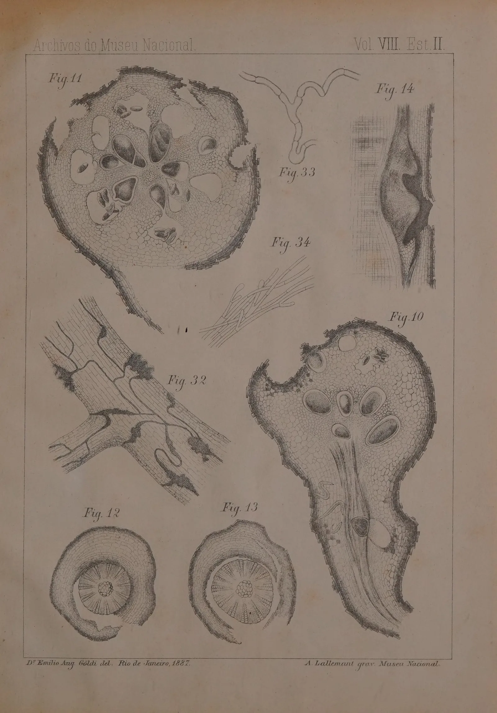 Planche gravée montrant en très fort grossissement deux galles de radicelle ouvertes en coupe, la chair du renflement criblée de logettes où sont lovés les vers, avec à côté les radicelles déformées vues de l'extérieur et des coupes circulaires du tissu envahi.